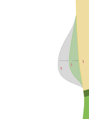 Flatten Your Curve - 4 maanden leeftstijlprogramma